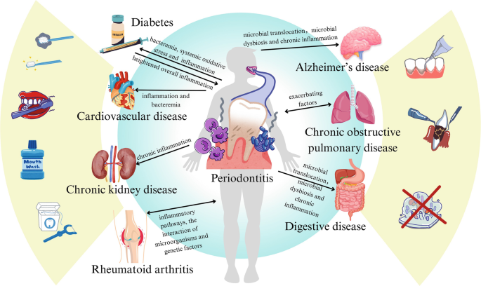 Periodontal Medicine & Systemic Health - Dental Planet